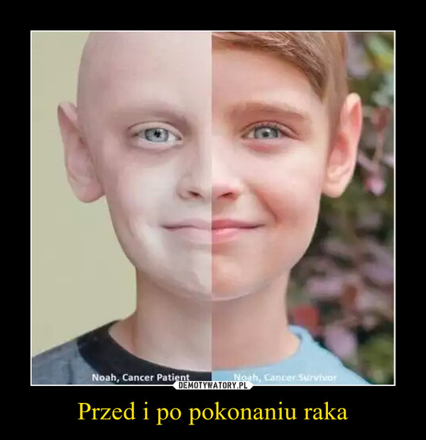 Przed i po pokonaniu raka –  