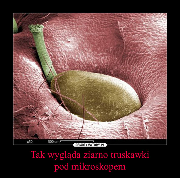 Tak wygląda ziarno truskawkipod mikroskopem –  