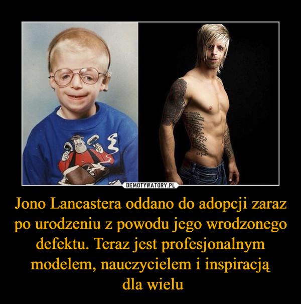 Jono Lancastera oddano do adopcji zaraz po urodzeniu z powodu jego wrodzonego defektu. Teraz jest profesjonalnym modelem, nauczycielem i inspiracją dla wielu –  